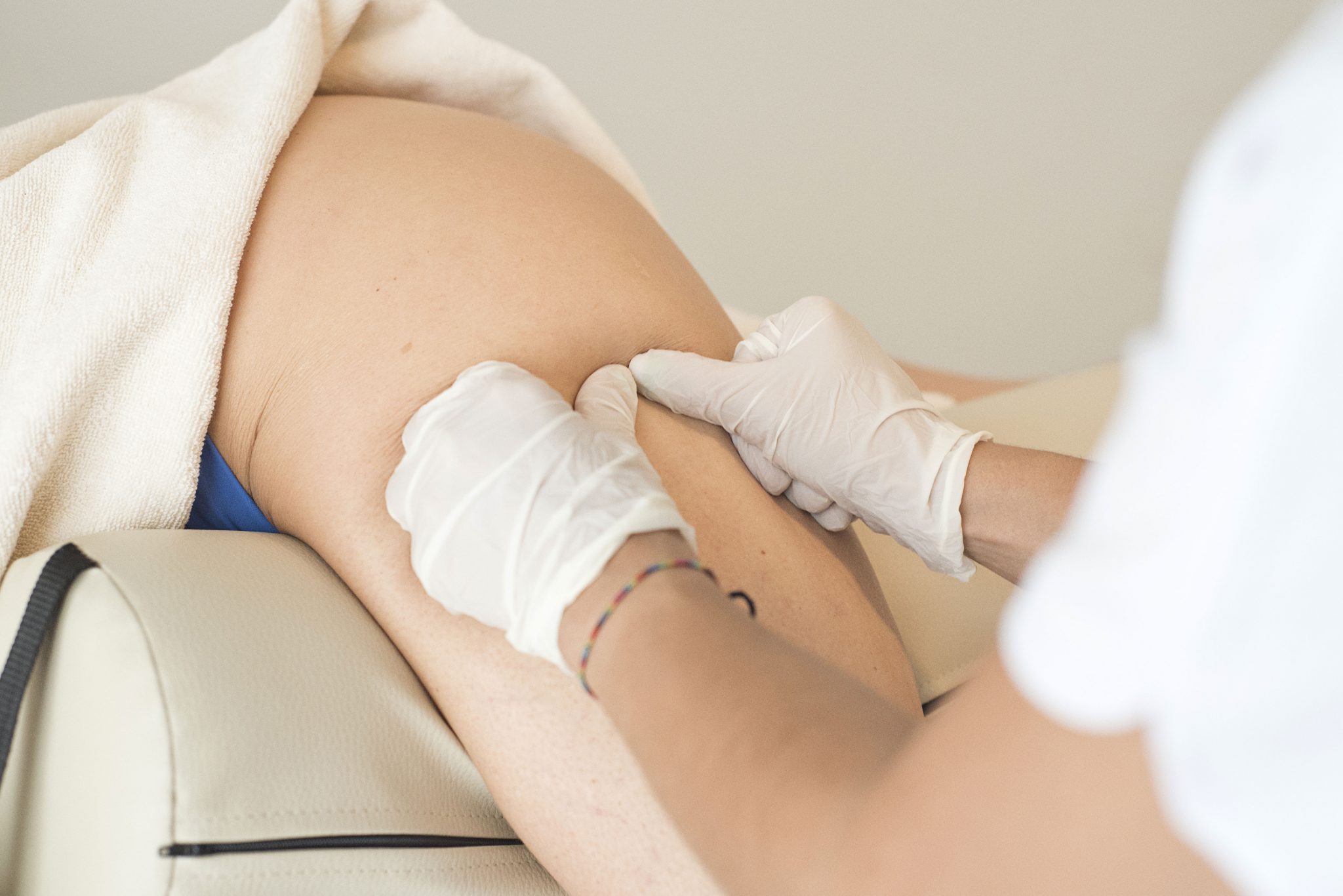 Bursitis: Síntomas, Causas y Tratamientos Efectivos