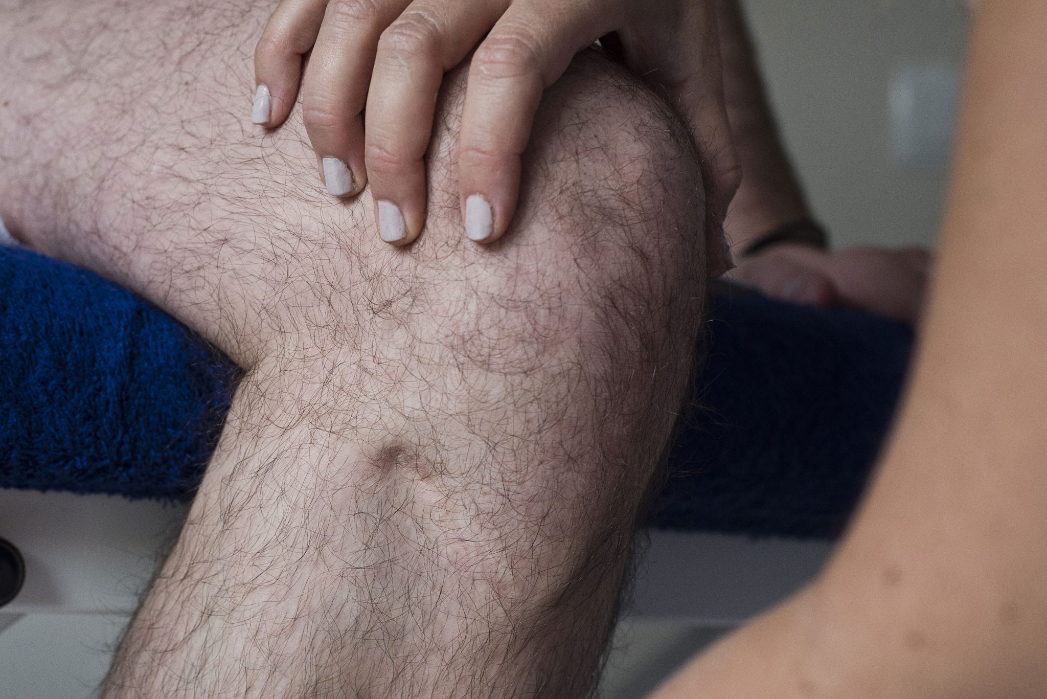 Tratamientos para la Condromalacia Rotuliana en Fisioterapia