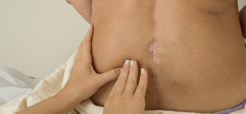 Terapia de columna vertebral